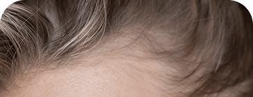 Imagem cabelo fino