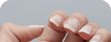 Imagem unhas